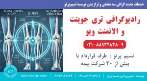تری جوینت (Three Joints) و الانمنت ویو (Alignment View)