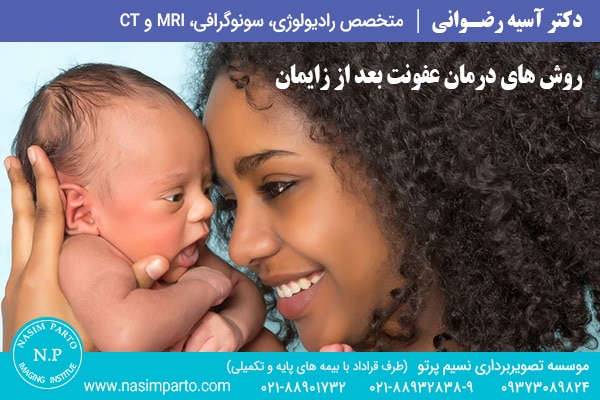 روش های درمان عفونت بعد از زایمان