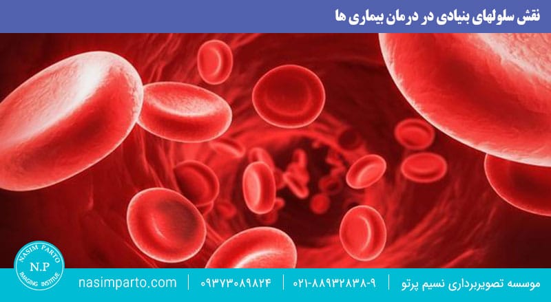 نقش سلولهای بنیادی در درمان بیماری ها