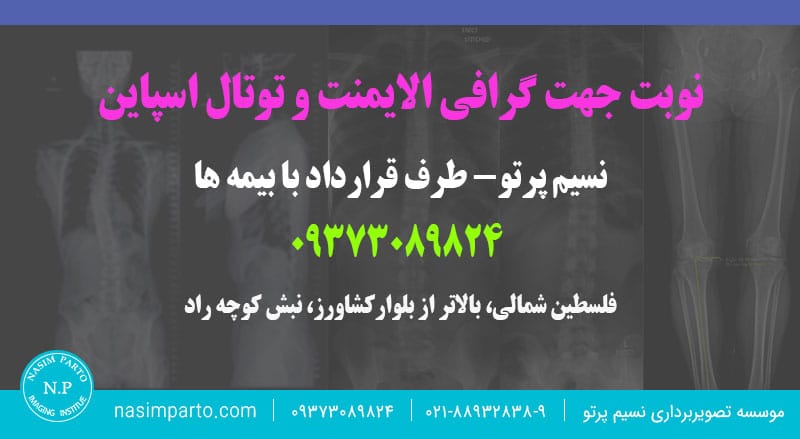نوبت-جهت-گرافی-الایمنت-و-توتال-اسپاین2 دریافت نوبت جهت گرافی الایمنت و توتال اسپاین
