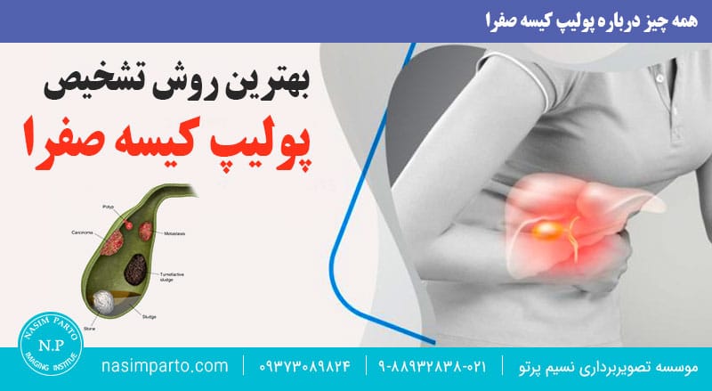 پولیپ کیسه صفرا چیست