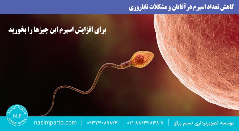 علت های کم شدن اسپرم مردها