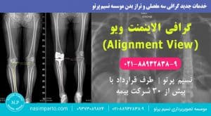 گرافی-الاینمنت-ویو-(Alignment-View)